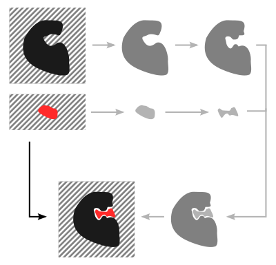 Quantum Chemical Free Energy Decomposition